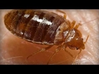BED BUGS KILLER : 3 MOST POWERFUL NATURAL REMEDIES FOR BED BUGS