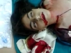 The injury of a girl from shot by Syrian army sniper