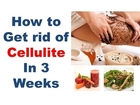 How to get rid of cellulite fast on thighs, Remove cellulite naturally, Best cellulite treatment